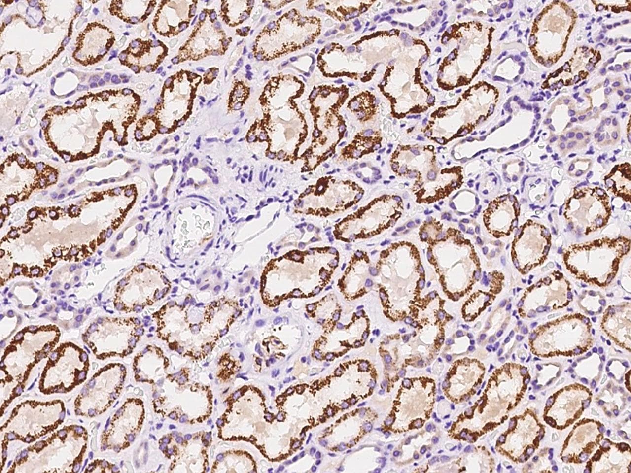 Polyclonal Rabbit anti-Human ZDHHC4 Antibody (IHC)
