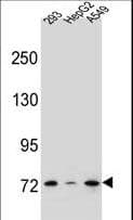 ZNF569 Antibody (aa82-111)