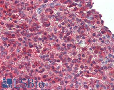 IHC-plus™ Polyclonal Rabbit anti-Human LILRB2 / ILT4 Antibody (IHC, WB)