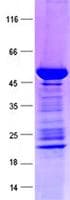 Human STAR Protein (Recombinant GST, N-terminus + His, C-terminus)