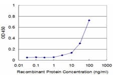 IHC-plus™ RHEB Antibody (clone 2C11)