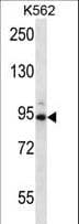 CCNT1 / Cyclin T1 Antibody (aa253-281)