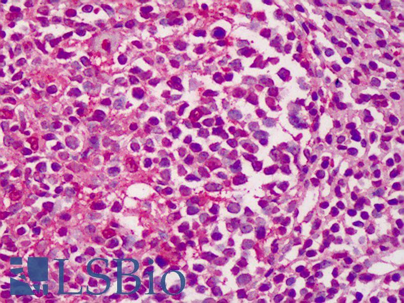 IHC-plus™ Polyclonal Rabbit anti-Human COL25A1 / Collagen XXV Antibody (aa430-443, IHC)