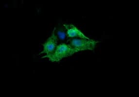 RAB30 Antibody (clone OTI4B9)