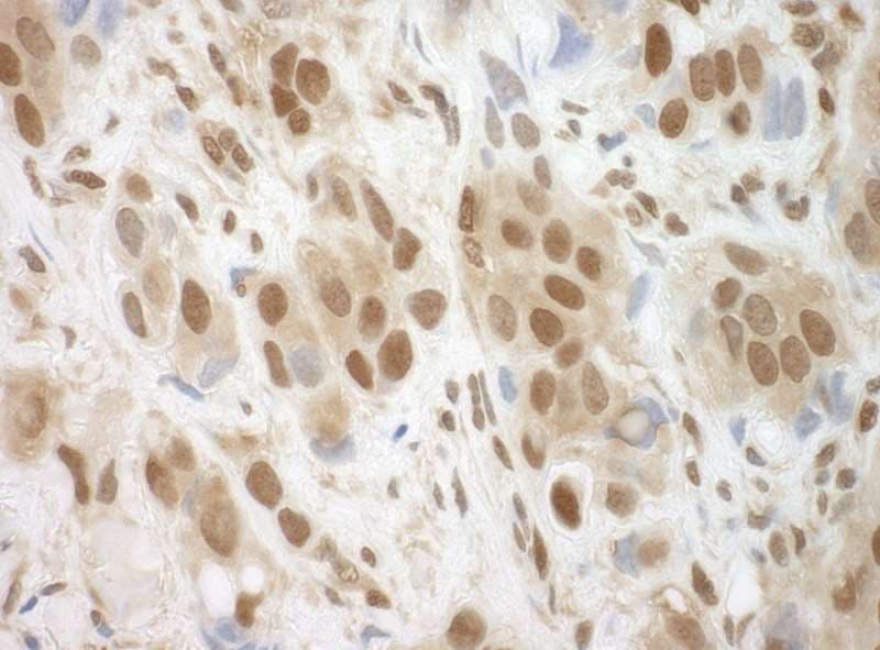 BRCC3 / BRCC36 Antibody (aa266-316)