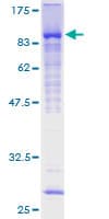 Human ZNF394 Protein (Recombinant GST)