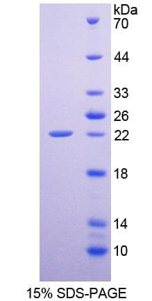 Rat EREG / Epiregulin Protein (Recombinant His-T7)
