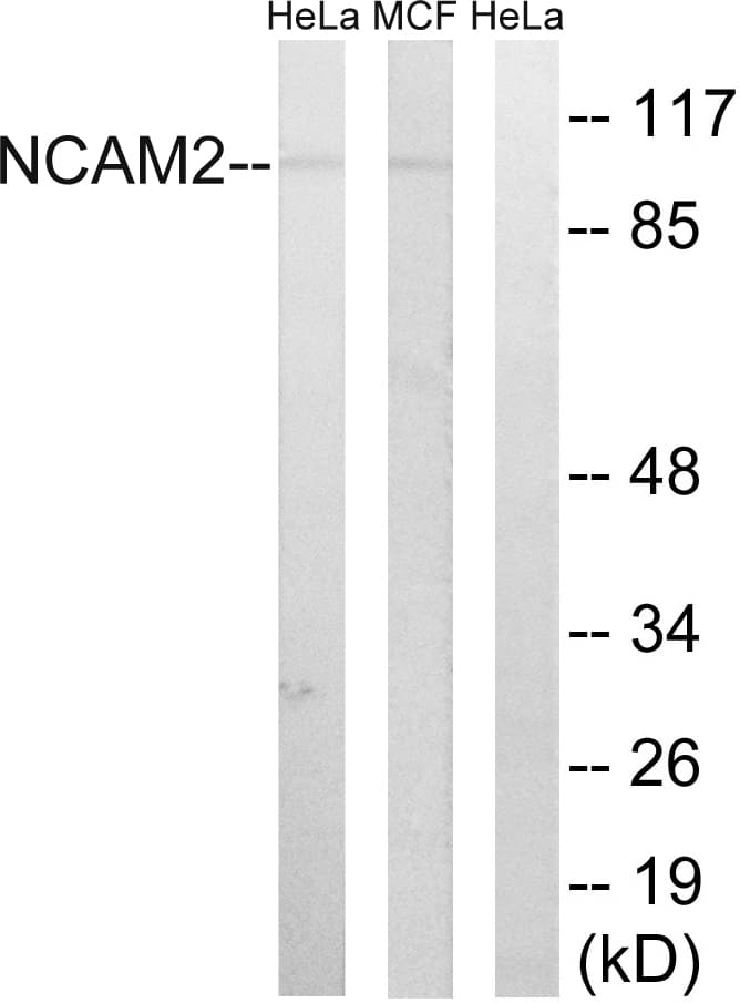 Polyclonal Rabbit anti-Human NCAM2 Antibody (aa264-313, WB)