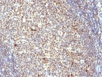 Monoclonal Mouse anti-Human NUMA1 / NUMA Antibody (clone SPM300, IHC, IF, WB)