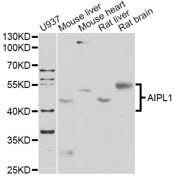 Polyclonal Rabbit anti-Human AIPL1 Antibody (IF, WB)