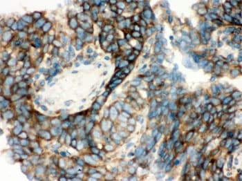 Polyclonal Rabbit anti-Human YBX1 / YB1 Antibody (IHC, WB)