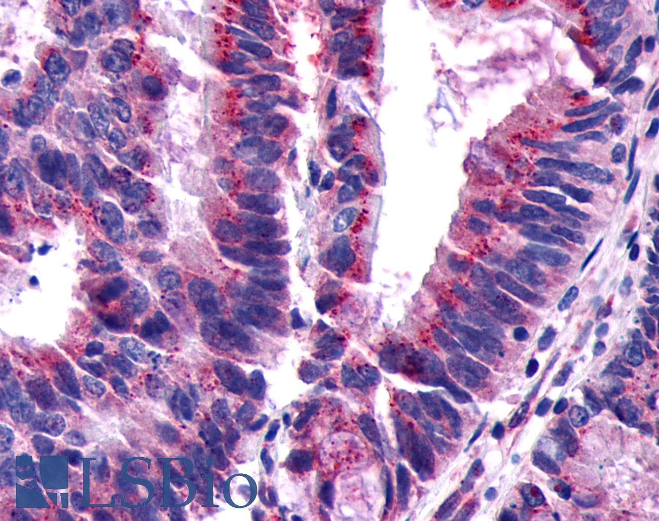 PathPlus™ GPCR6 / GPR101 Antibody (Cytoplasmic Domain)
