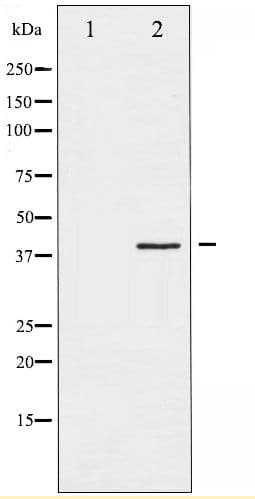 FOS / c-FOS Antibody (phospho-Ser362)