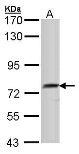 QSOX1 / QSCN6 Antibody (aa231-617)