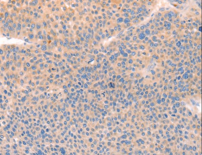 CD109 Antibody