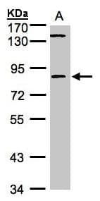 LIMK2 Antibody (aa294-655)