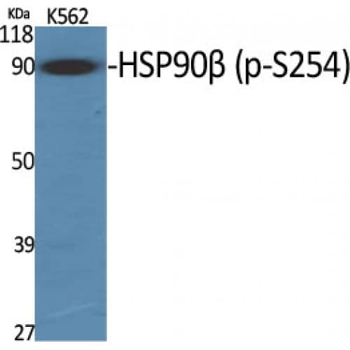 Polyclonal Rabbit anti-Human HSP90 Beta Antibody (200-280 aa, IHC, IF, WB)