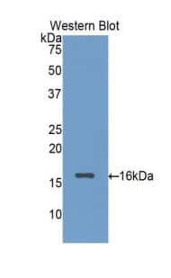 LGALS1 / Galectin 1 Antibody (aa1-135)