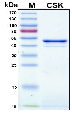 Human c-Src Kinase / CSK Protein (Recombinant 6His, N-terminus)