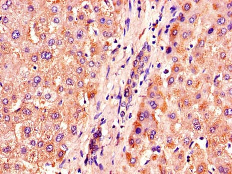 Polyclonal Rabbit anti-Human ACOX1 / ACOX Antibody (IHC, IF)