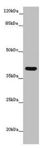Polyclonal Rabbit anti-Human MR1 Antibody (IHC, IF, WB)