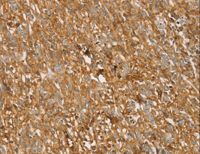Polyclonal Rabbit anti-Human TMPRSS11F Antibody (IHC, WB)