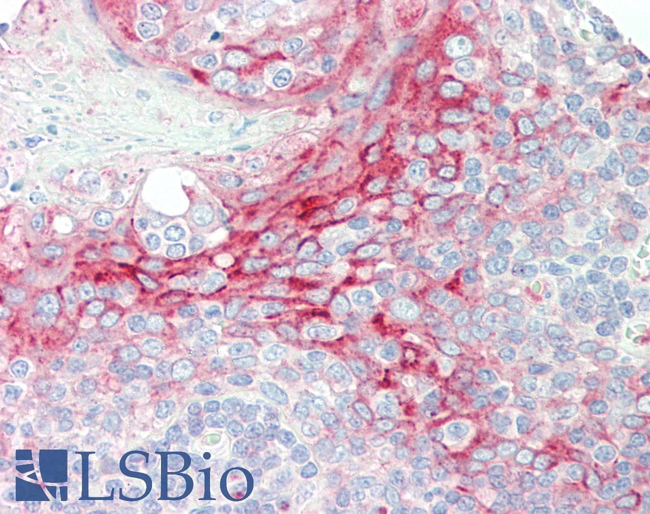 IHC-plus™ TMBIM1 Antibody