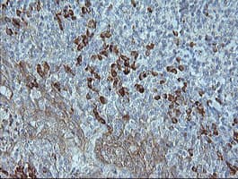MAPK9 / JNK2 Antibody (clone OTI2G3, Carrier-free)