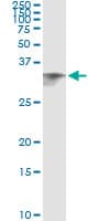 CIDEA / CIDE-A Antibody (clone 4B9)