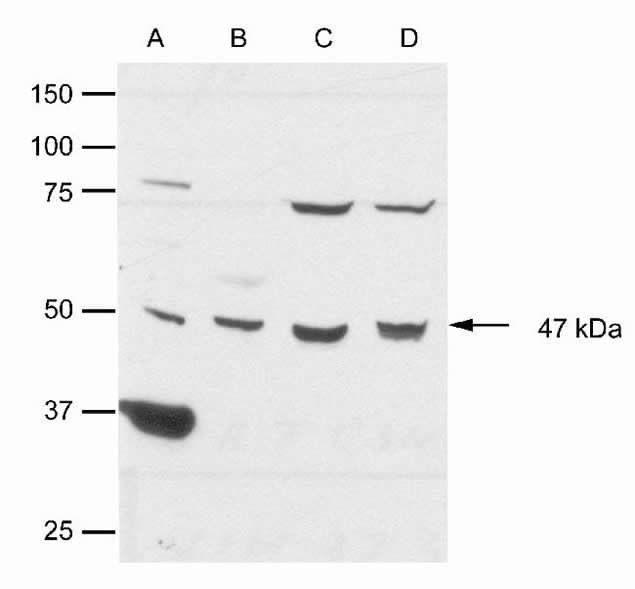 CSNK1E / CK1 Epsilon Antibody (N-Terminus)