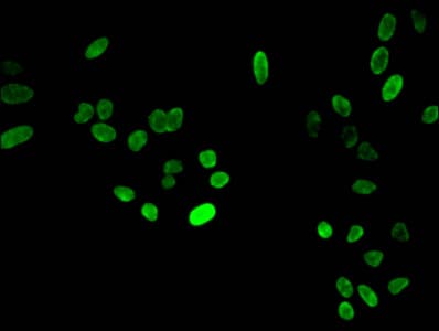 HIST1H4I Antibody