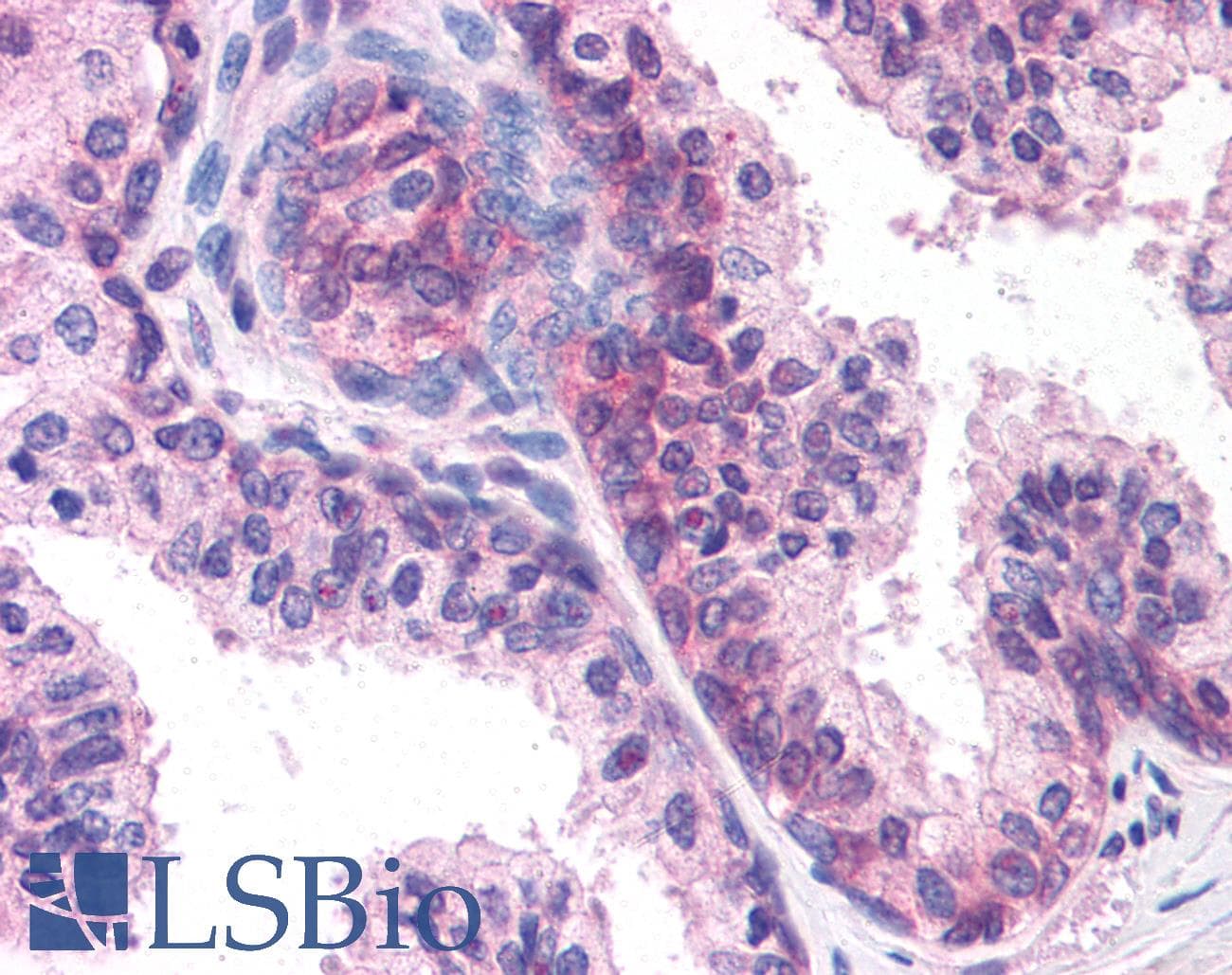 IHC-plus™ DHRS7 Antibody (Internal)