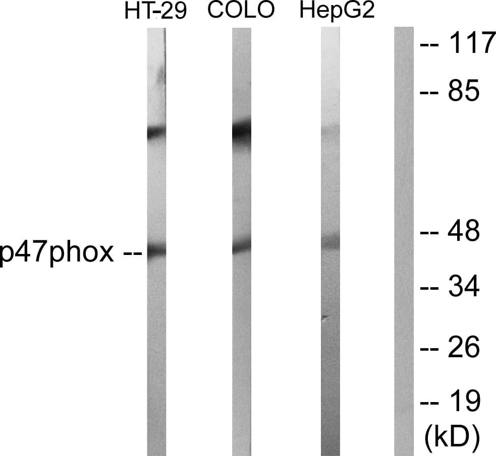 IHC-plus™ Polyclonal Rabbit anti-Human NCF1 / p47phox / p47 phox Antibody (aa341-390, IHC, WB)