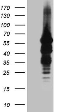 IMPDH2 Antibody (clone OTI2F10)