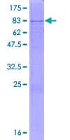 Human GAL3ST4 Protein (Recombinant GST)