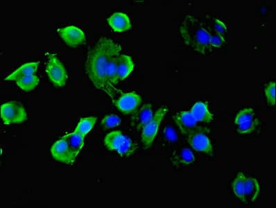 IDH1 / IDH Antibody