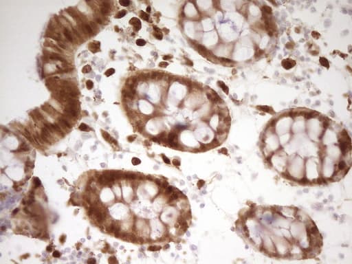 IHC-plus™ LGALS9 / Galectin 9 Antibody (clone 2A4)