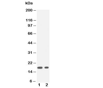IL-1B / IL-1 Beta Antibody (aa249-269)