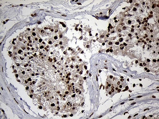 SPANXB1 Antibody (clone OTI6G2, Carrier-free)