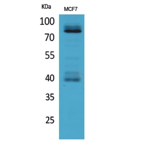 IL1R1 Antibody (31-80 aa, N-terminal)