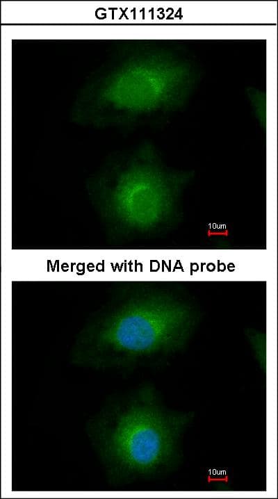 MVD Antibody (aa156-371)
