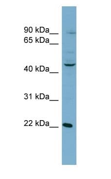 Polyclonal Rabbit anti-Human Aspartate Aminotransferase Antibody (N-Terminus, WB)