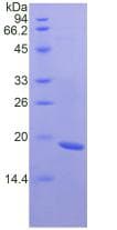 Human FNDC5 / Irisin Protein (Recombinant His)
