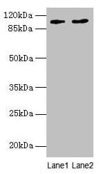 CCDC57 Antibody (Coiled-coil domain)