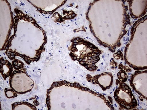 KRT18 / CK18 / Cytokeratin 18 Antibody (aa69-372, clone OTI10H8)