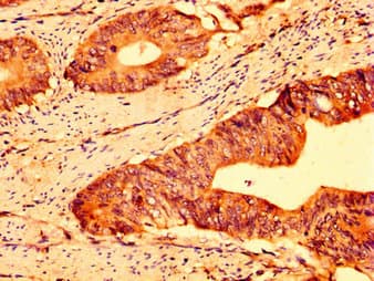 ABCG5 Antibody