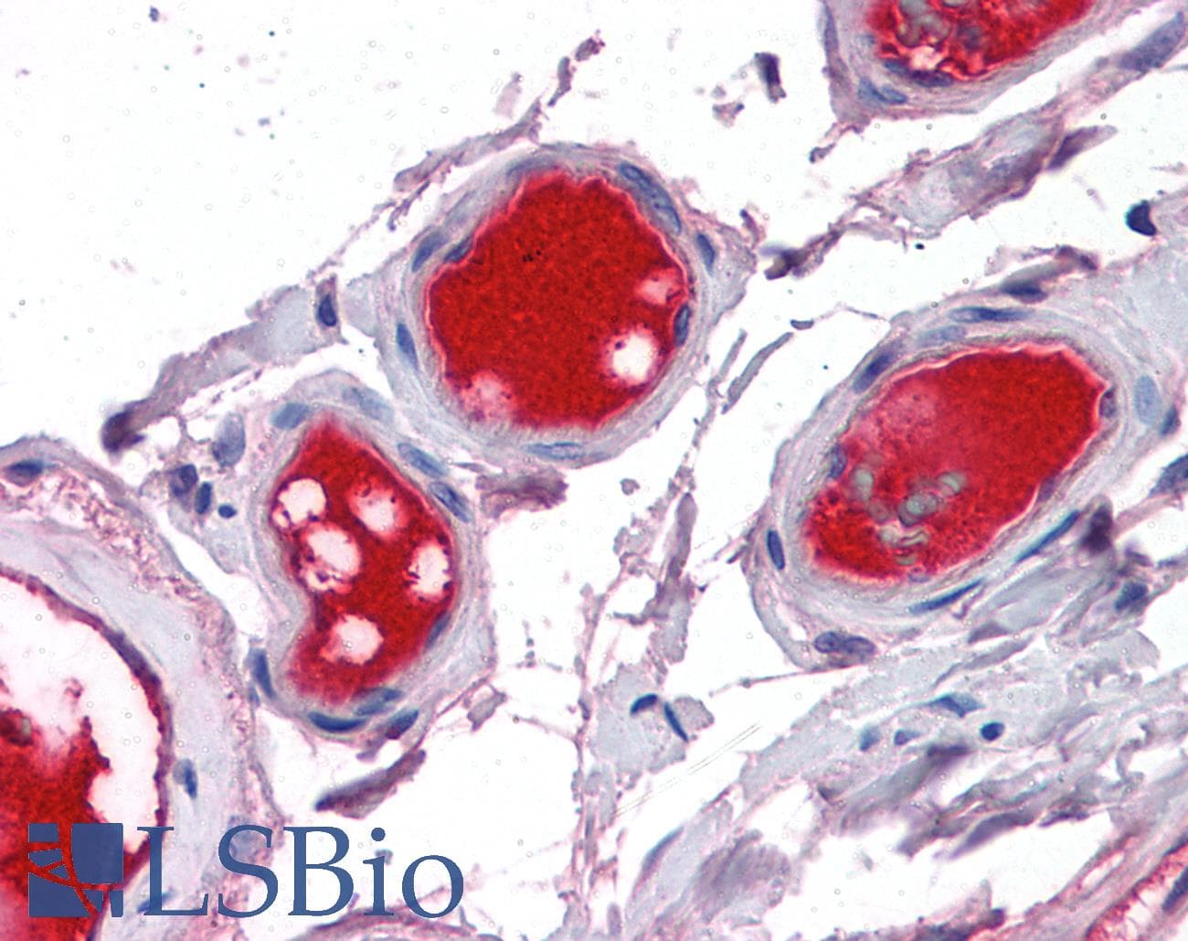 IHC-plus™ Polyclonal Sheep anti-Human F10 / Factor X Antibody (IHC)