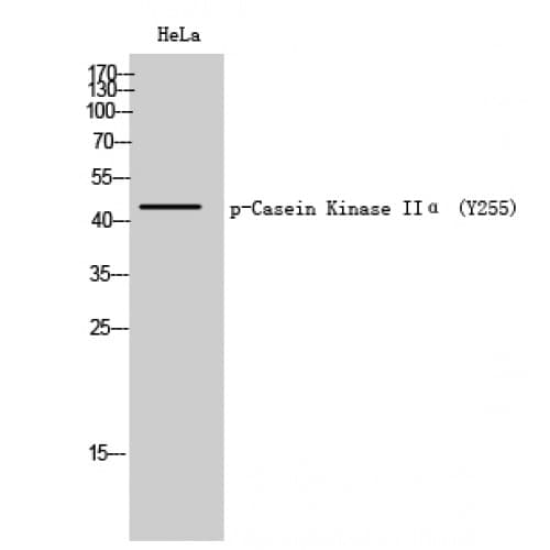 CSNK2A1 Antibody (190-270 aa)