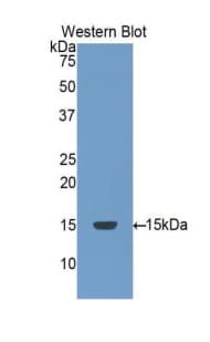 CASP8 / Caspase 8 Antibody (aa385-479)