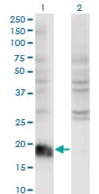 ARF6 Antibody (clone 2A4)